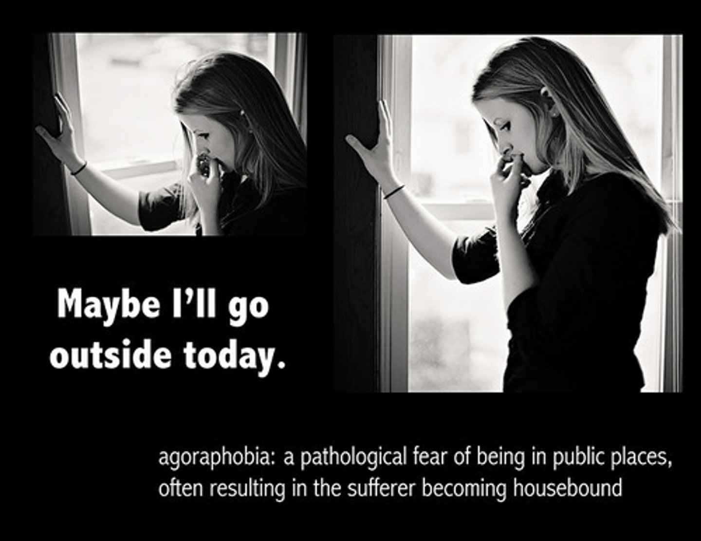 <p>- longer duration of illness</p><p>- severe agoraphobia (fear of situations where escape might be difficult)</p><p>- excessive sensitivity to physical Sx of anxiety</p><p>- comorbid personality, mood, or other anxiety disorder</p>