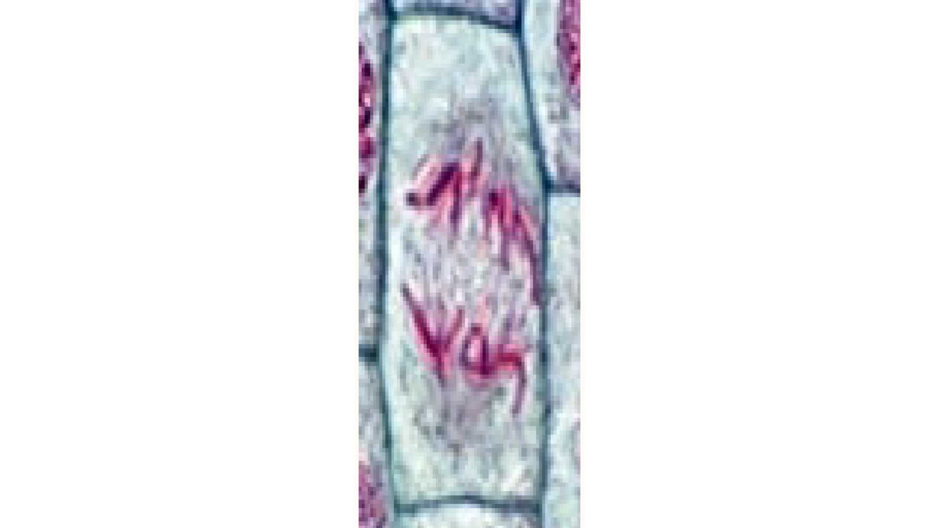 <p>What stage is the cell in?</p>