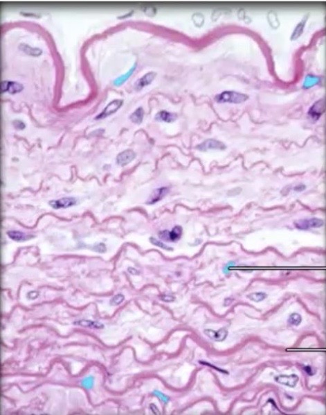 term image