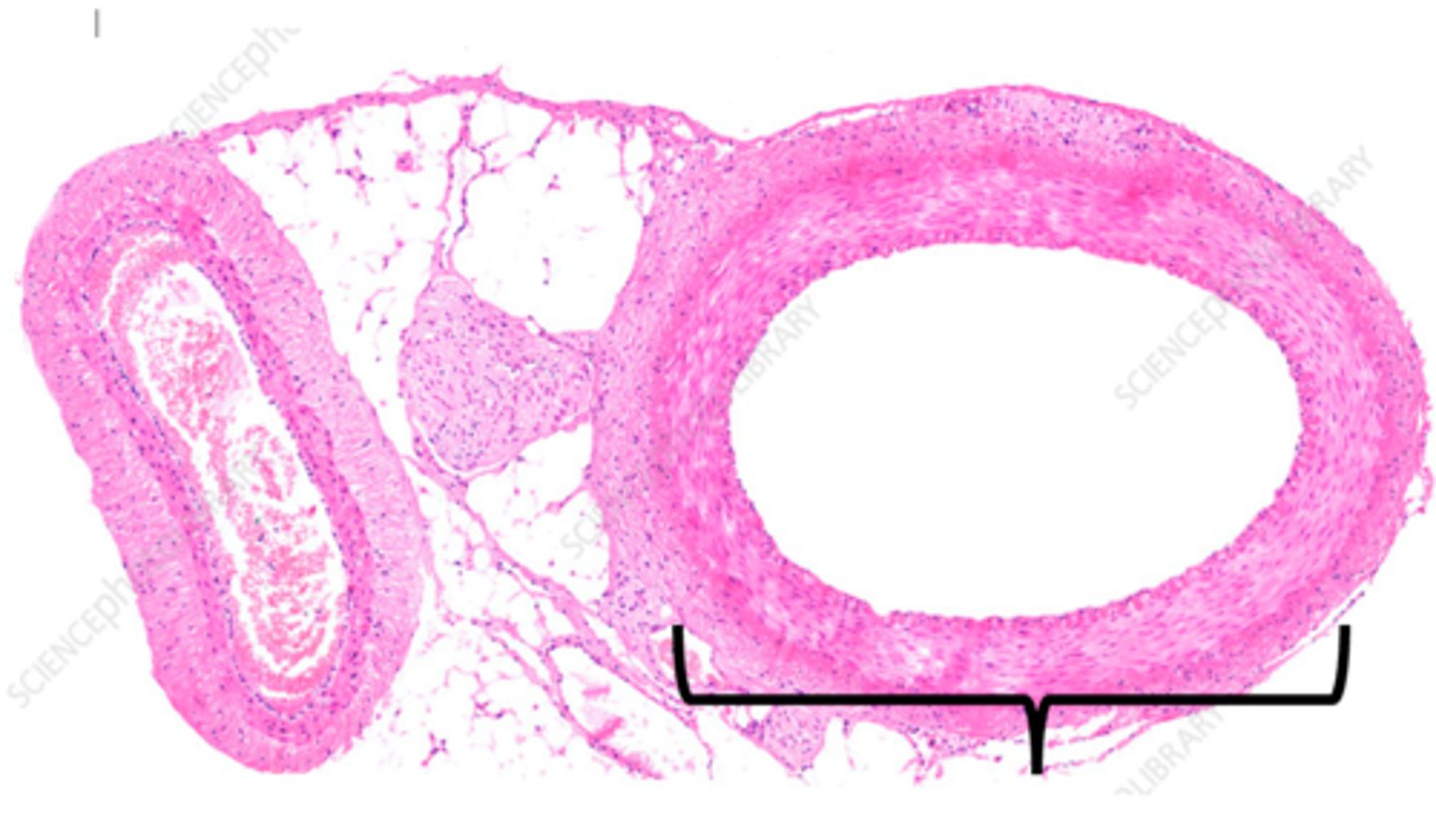 <p>a blood vessel that carries blood away from the heart</p>