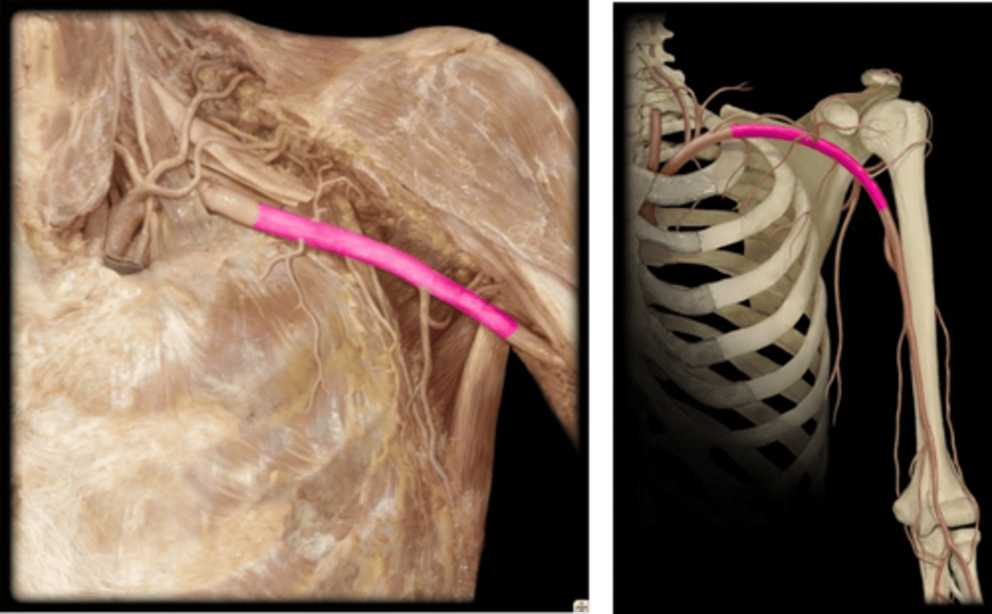 <p>Name this vessel.</p>