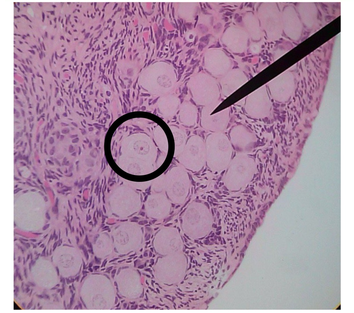 <p>Primordial follicle </p>