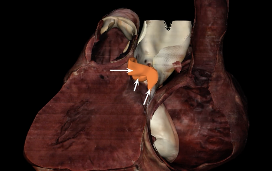 <p>What is highlighted in orange?</p>