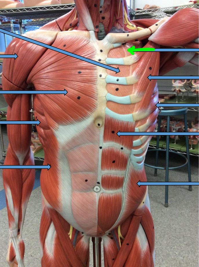 <p>Identify this muscle?</p>