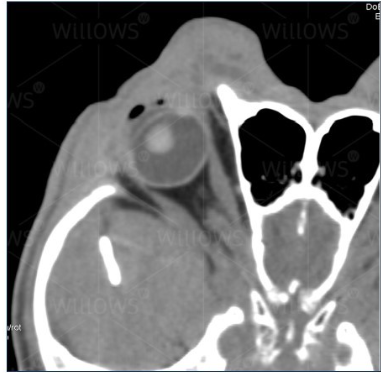 <p>Yes</p><p>CT scan</p>
