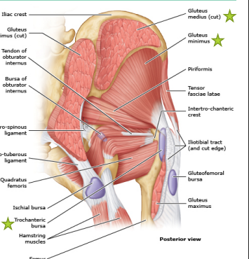 <p><strong>Greater Trochanteric Pain Syndrome</strong>: <strong>Background</strong></p><p>-________ medius or minimus _____________ with or without bursa involvement </p><p>-Risk Factors</p><ul><li><p>_________, obesity, back/knee/foot pain, ___________, and leg length discrepancy </p></li></ul><p>-Mechanism of Injury</p><ul><li><p>__________ overload from ________, stair climbing, or running </p></li></ul><p></p>