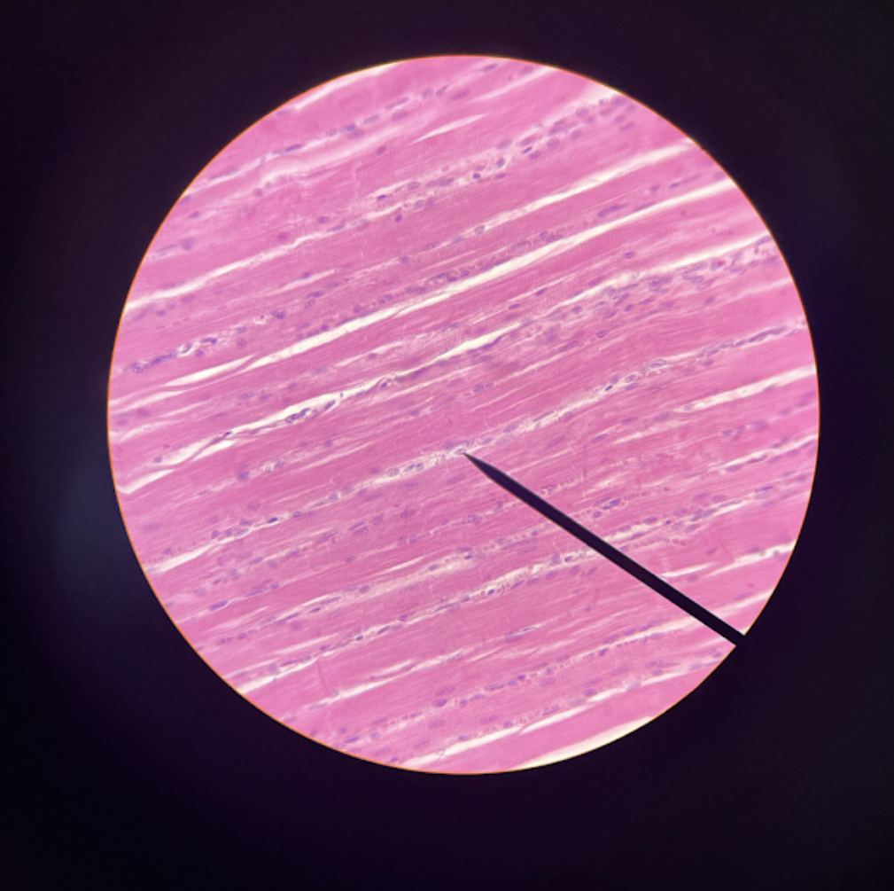 term image