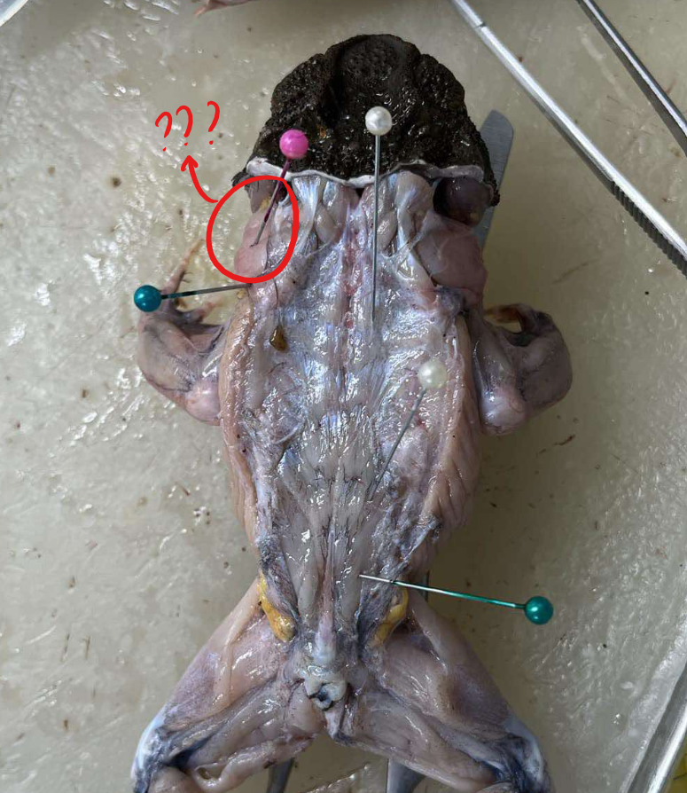 <p>muscles covering the outer surface of the suprascapula</p>