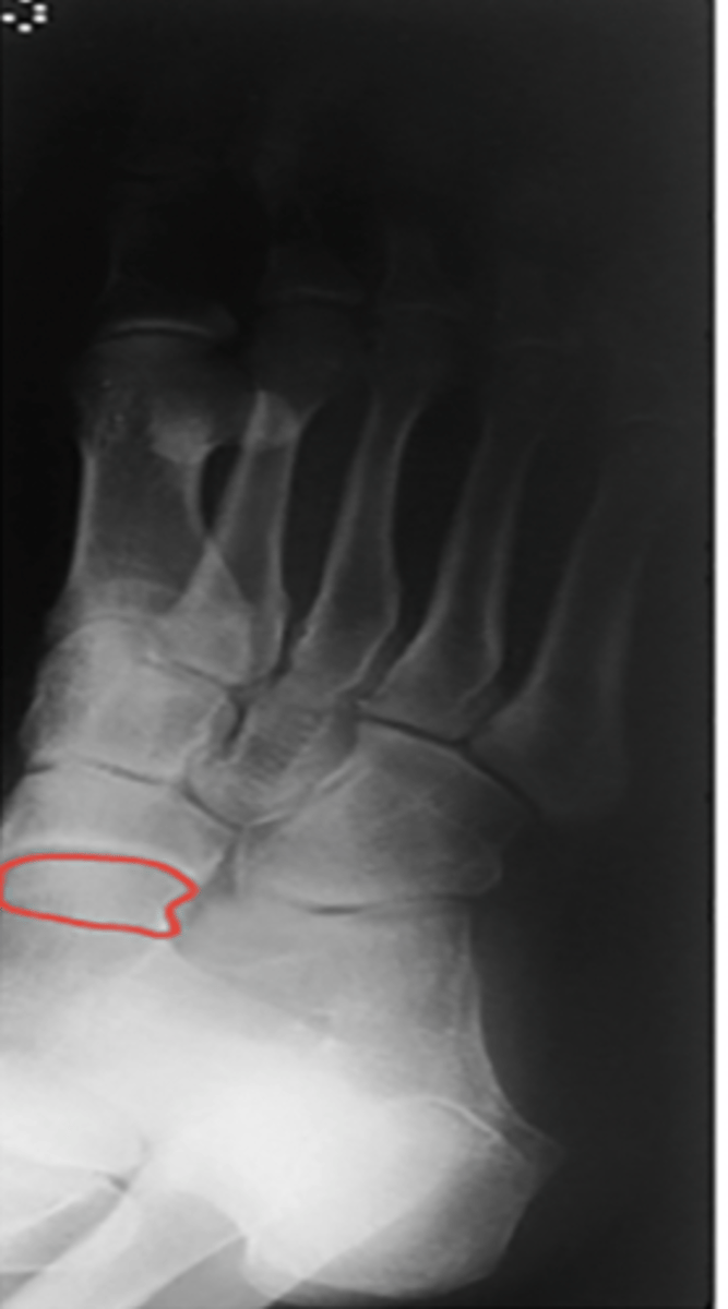 <p>What structure is highlighted?</p>
