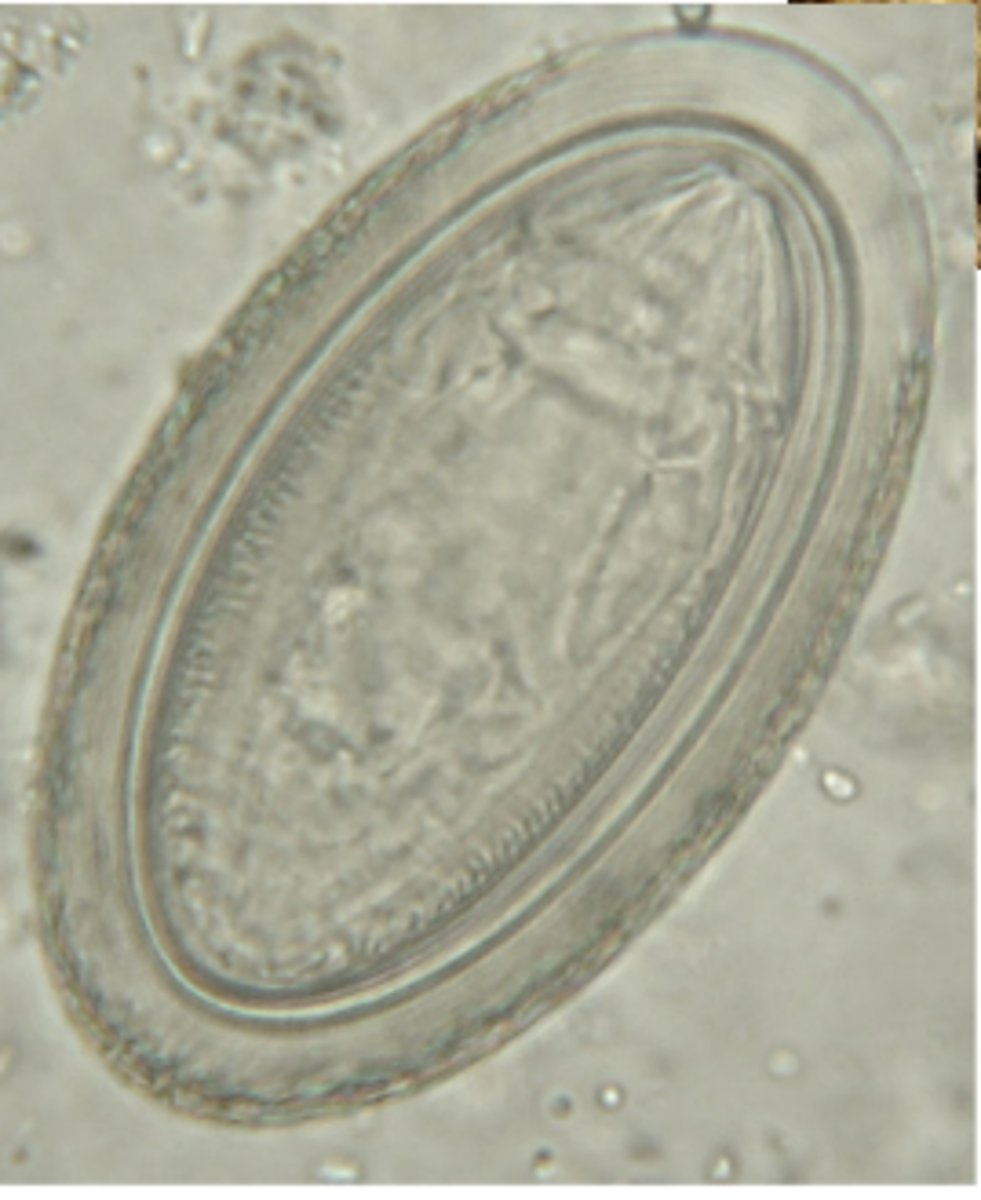 <p>What is this parasite that is found in monkeys? (WORDED DIFFERENT)</p>