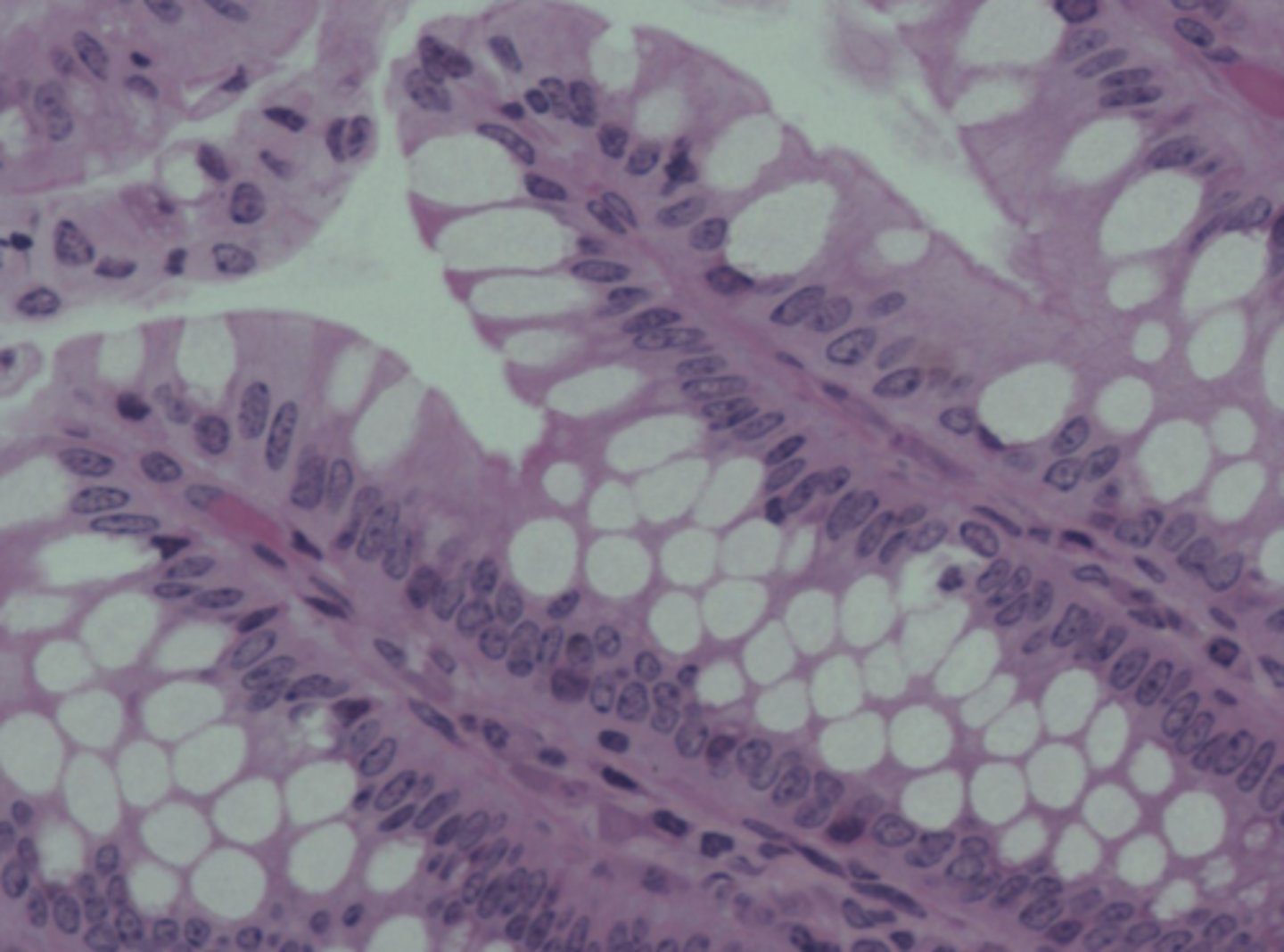 <p>B) Name all cell types and the predominant cell type</p>