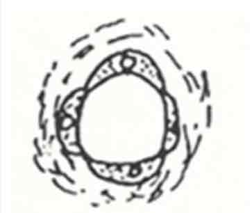 term image