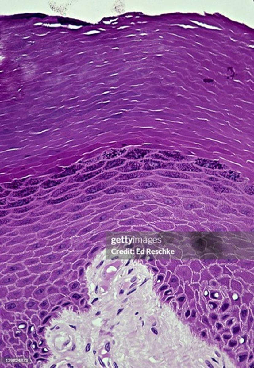 <p>Outer keratinized layer of the epidermis in terrestrial vertebrates.</p>
