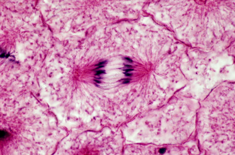 <p>Anaphase</p>