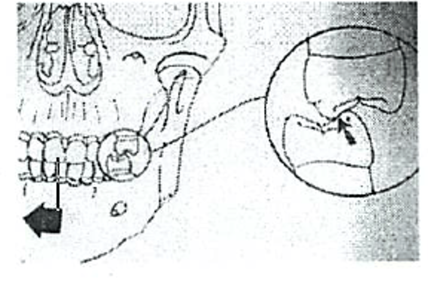 <p>b. nonworking interference</p>
