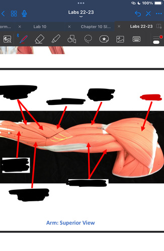 <p>What muscle is this?</p>