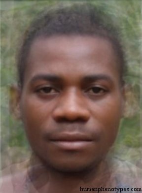 <p>Identify this Phenotype</p>