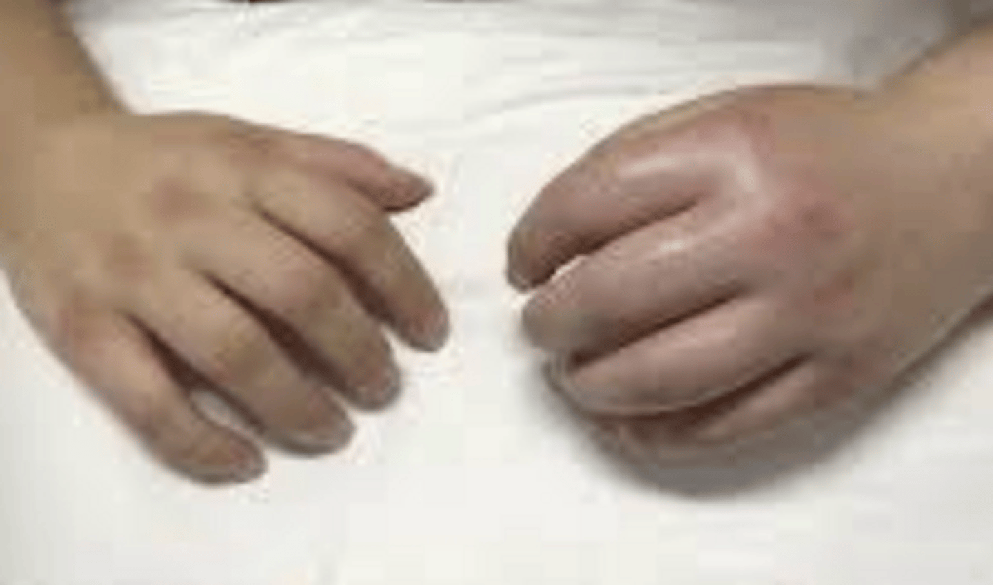 <p>hyperalgesia, allodynia, weakness, decreased movement, skin color and temperature changes</p>