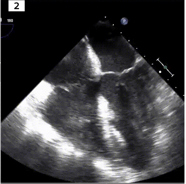 <p>Identify the view and structures of interest</p>