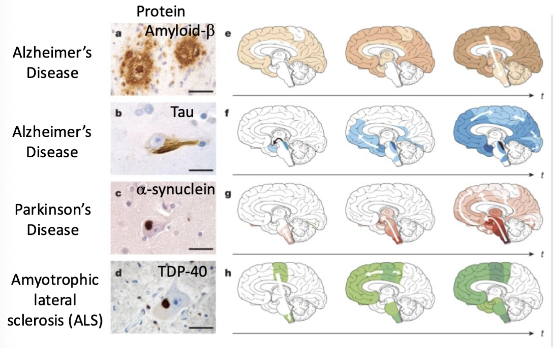 <p>the amyloids for each disease also aggregate in different areas in the brain, perhaps explaining the different initial symptoms associated with each disease (ex. parkinson’s = motor problems, alzheimer’s = memory loss)</p>