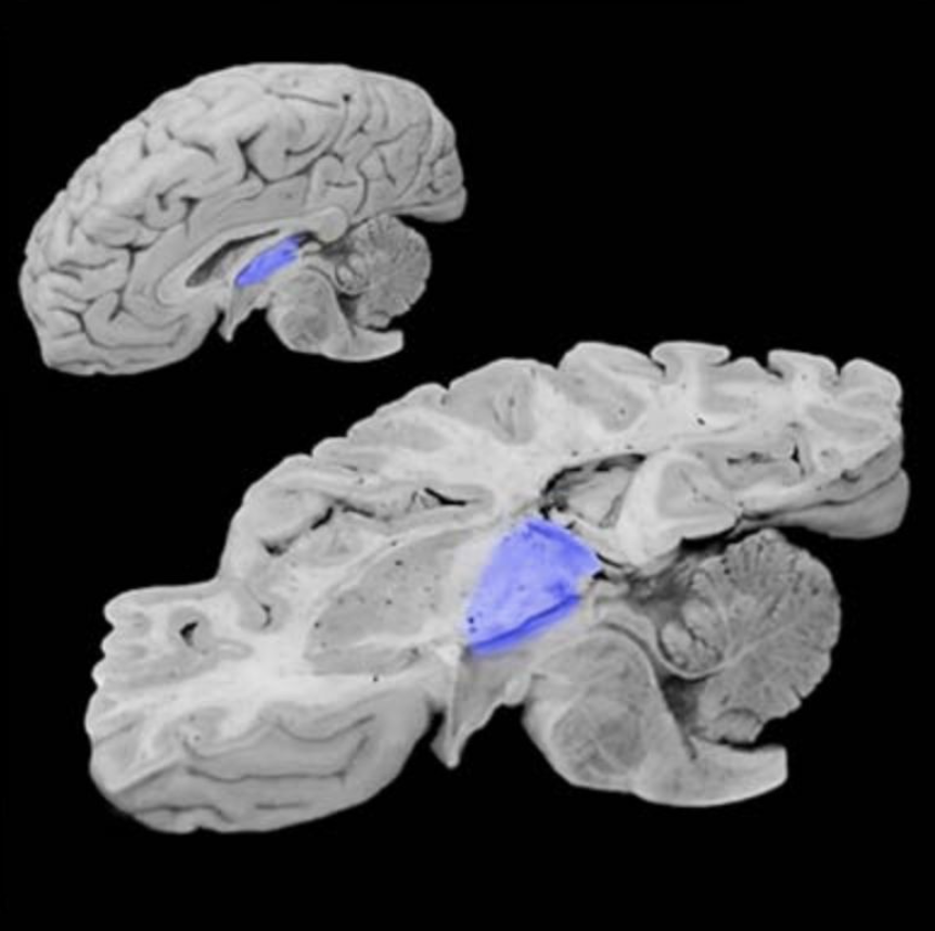 <p>Thalamus</p>