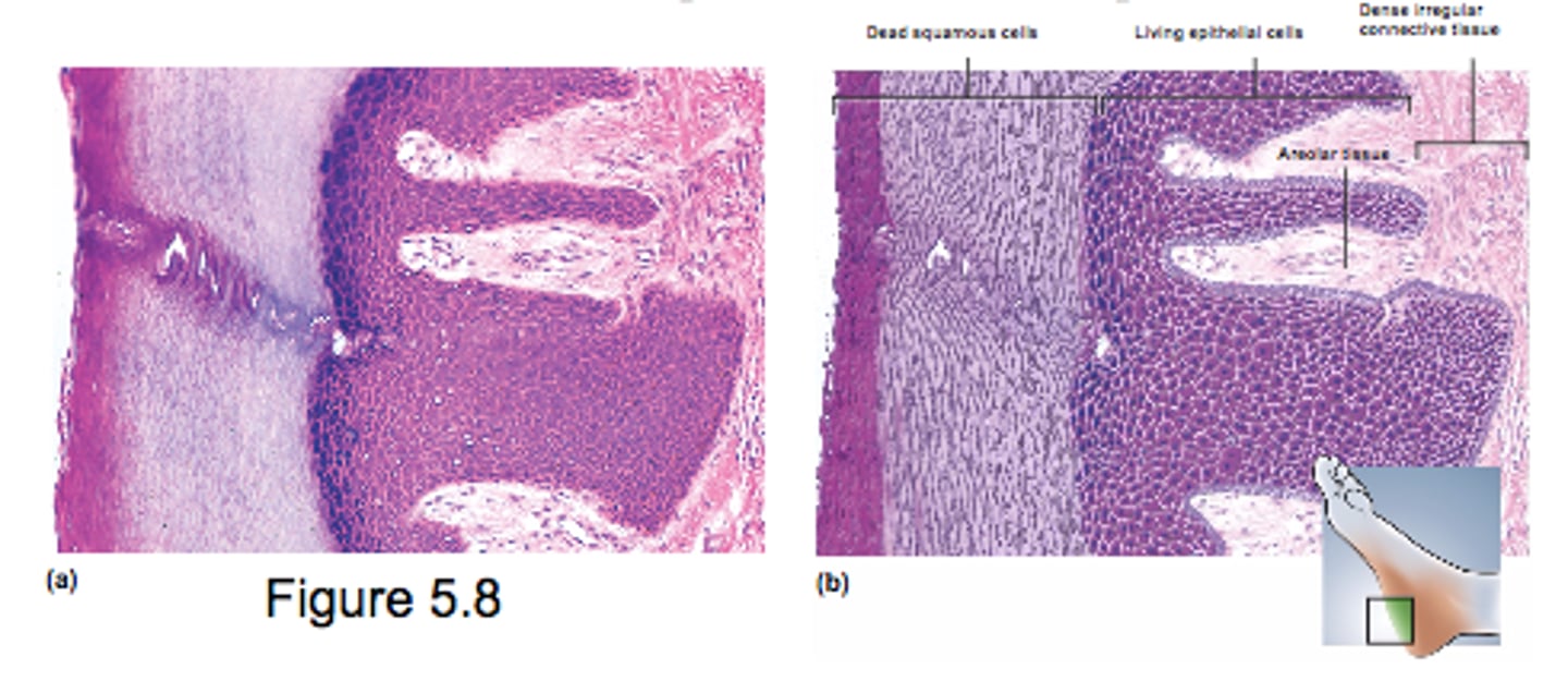 <p>- found on skin surface</p><p>- keratin increases abrasion resistance</p><p>- multiple cell layers (cells flatter at surface)</p><p>- external epidermis</p><p>- excellent protection</p>
