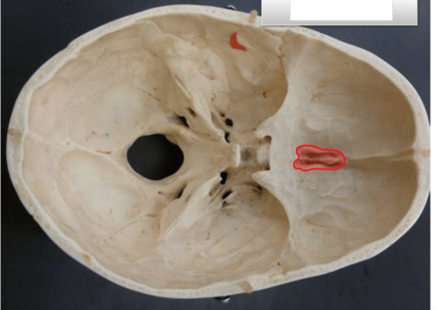 <p>Red highlighted</p>