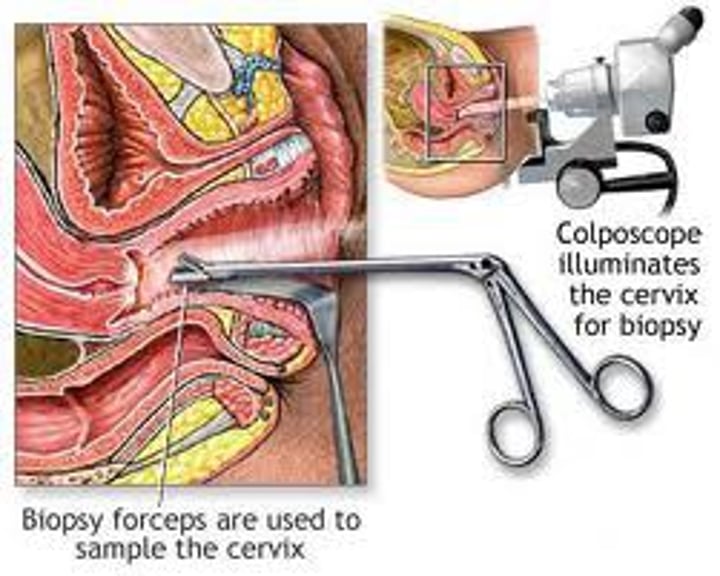 <p>visual examination of vagina</p>