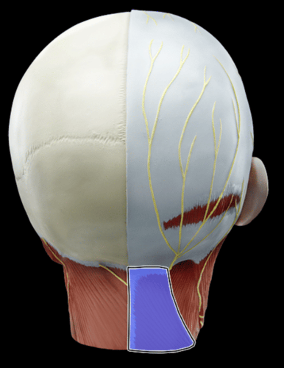 <p>What Muscle Is Highlighted?</p>