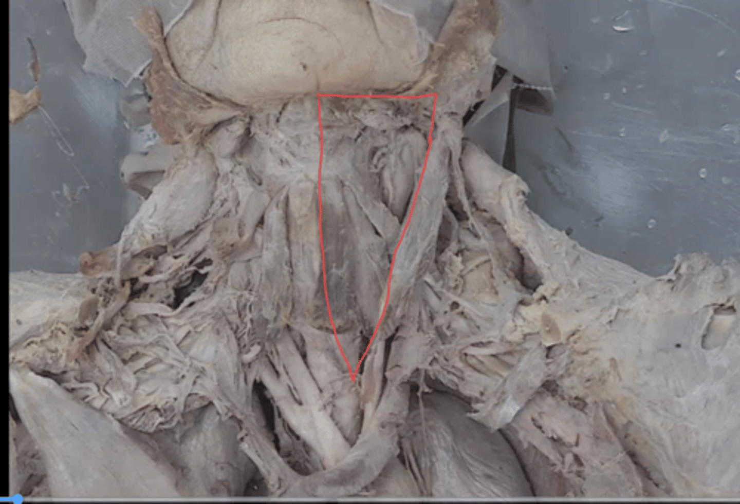 <p>identify this triangle</p>