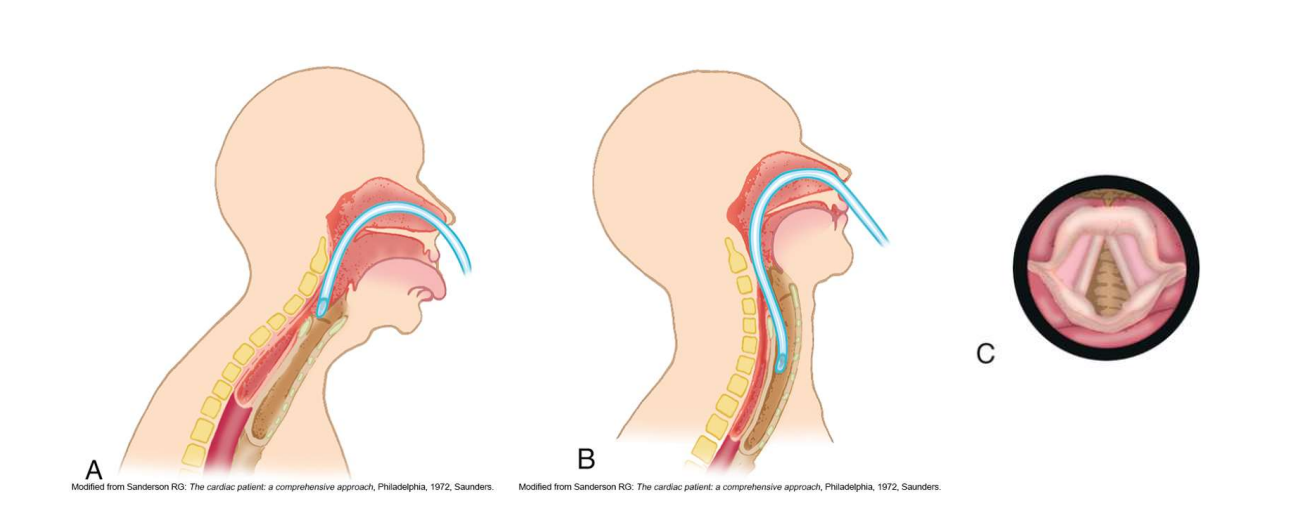 <p>Sniffing position</p>