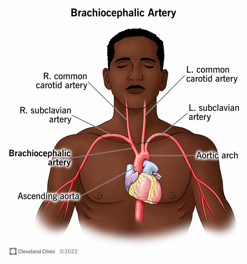 <p>right common carotid artery</p>