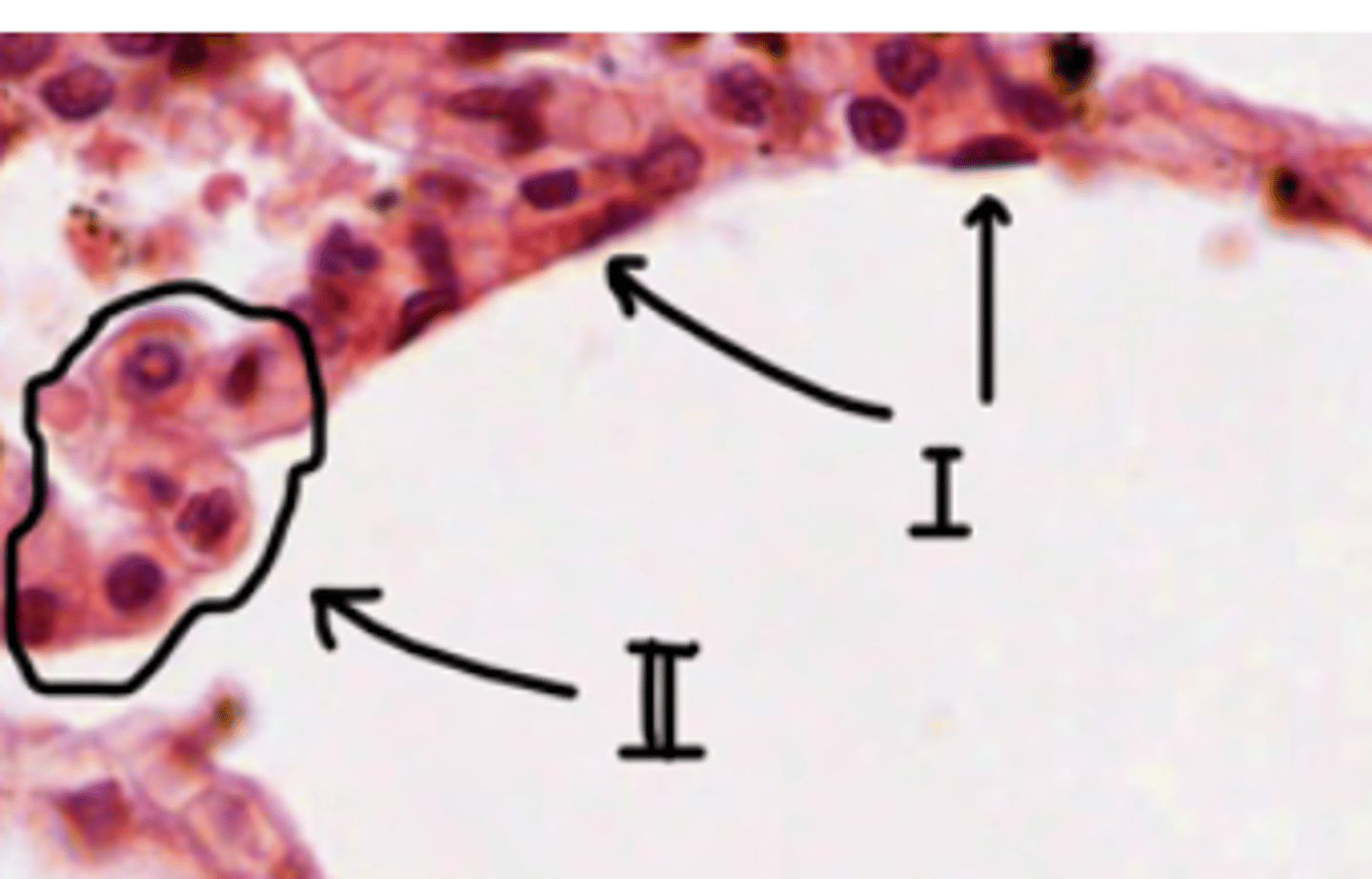 <p>Nucleus occupies almost the whole of the cell, very little cytoplasm = practically seen as deep purple dots.</p><p>They are lining in the alveoli</p>