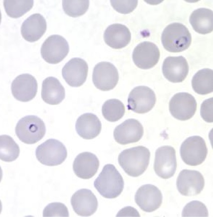<p>Identify: Protozoa</p>
