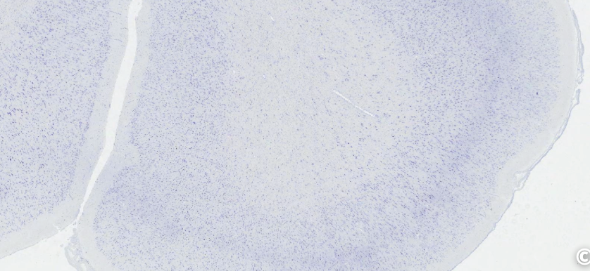 <p>what type of neural tissue is this</p>