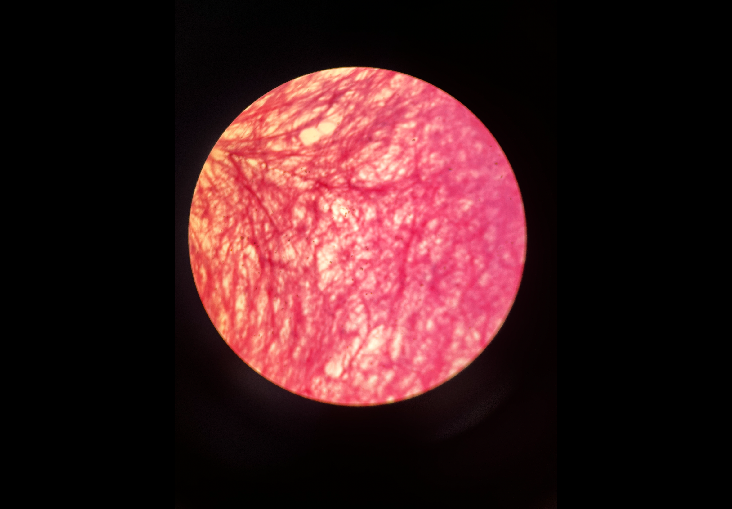 <p>Body location: surrounding nerves</p>