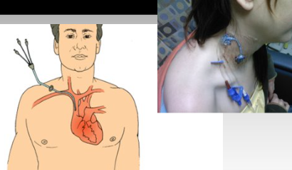 <p>what type of tube is this?</p>