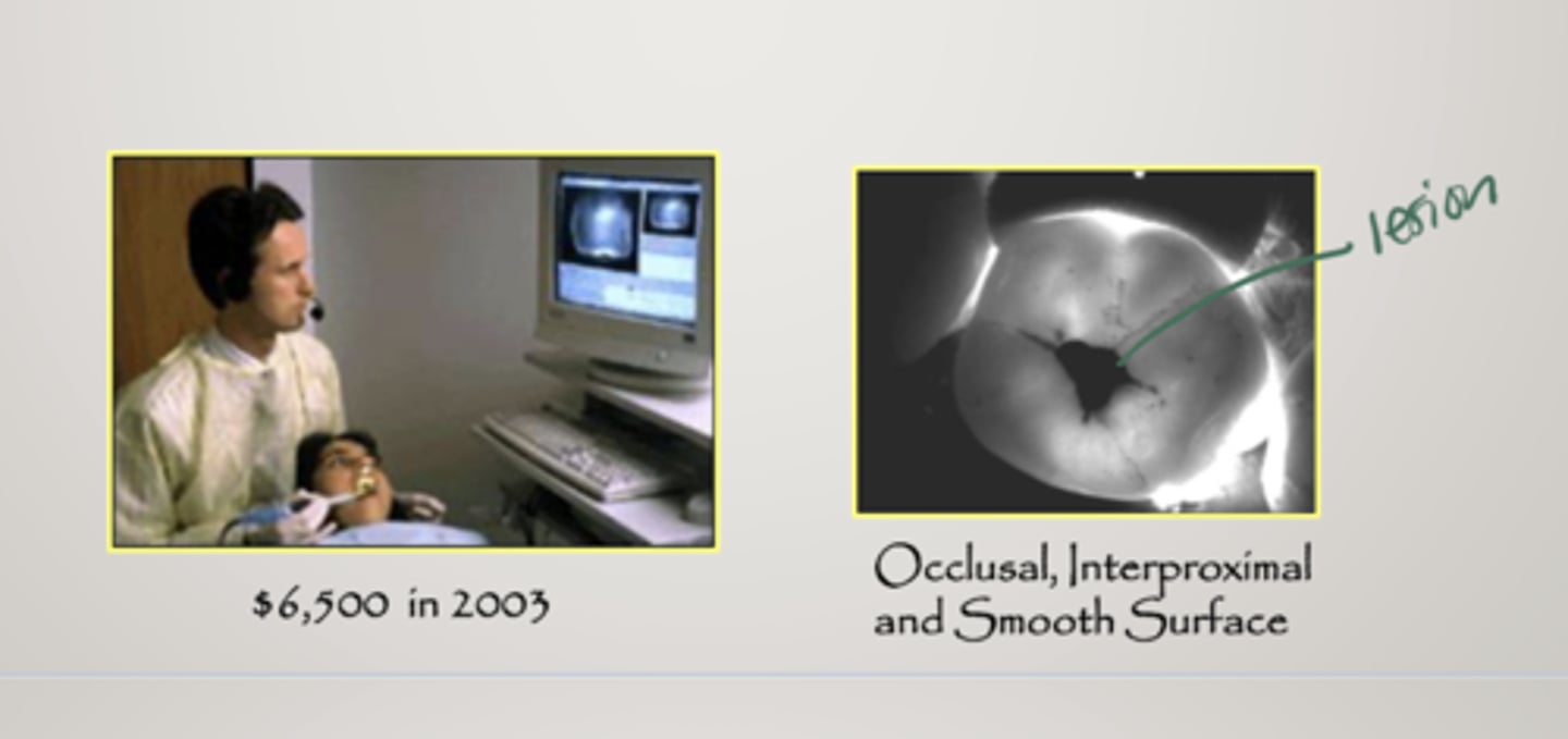 <p>uses visible light to create high resolution digital images</p><p>not quantitative, clinician must evaluate images</p><p>sensitivity high/lower than radiographs</p><p>specificity is approximately the same</p>