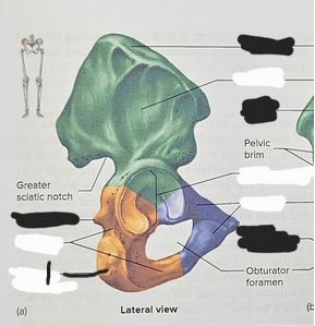 <p>What is structure #1?</p>