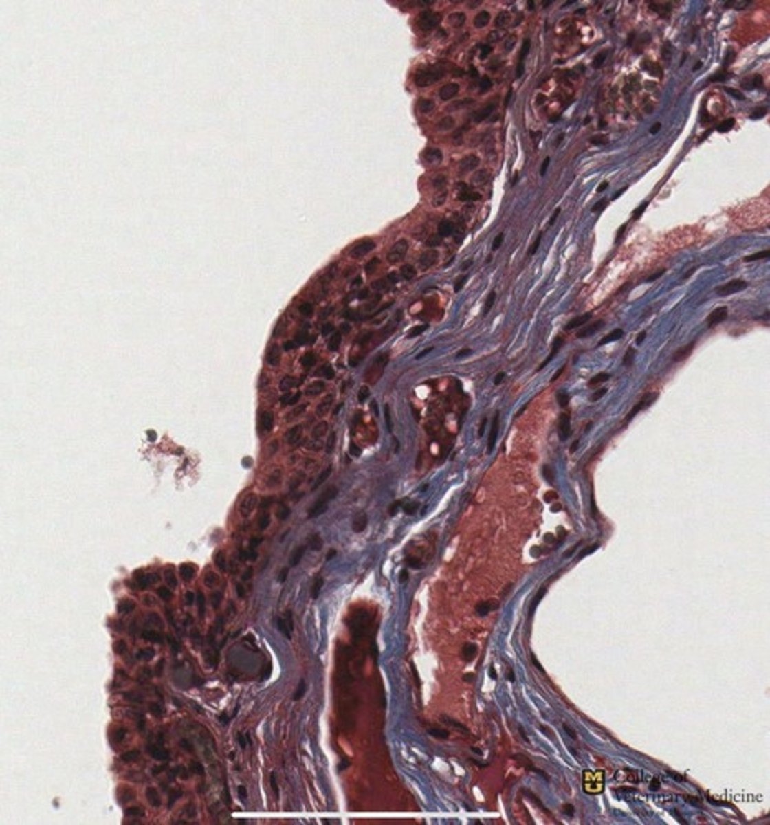 <p>What epithelial tissue is shown?</p>