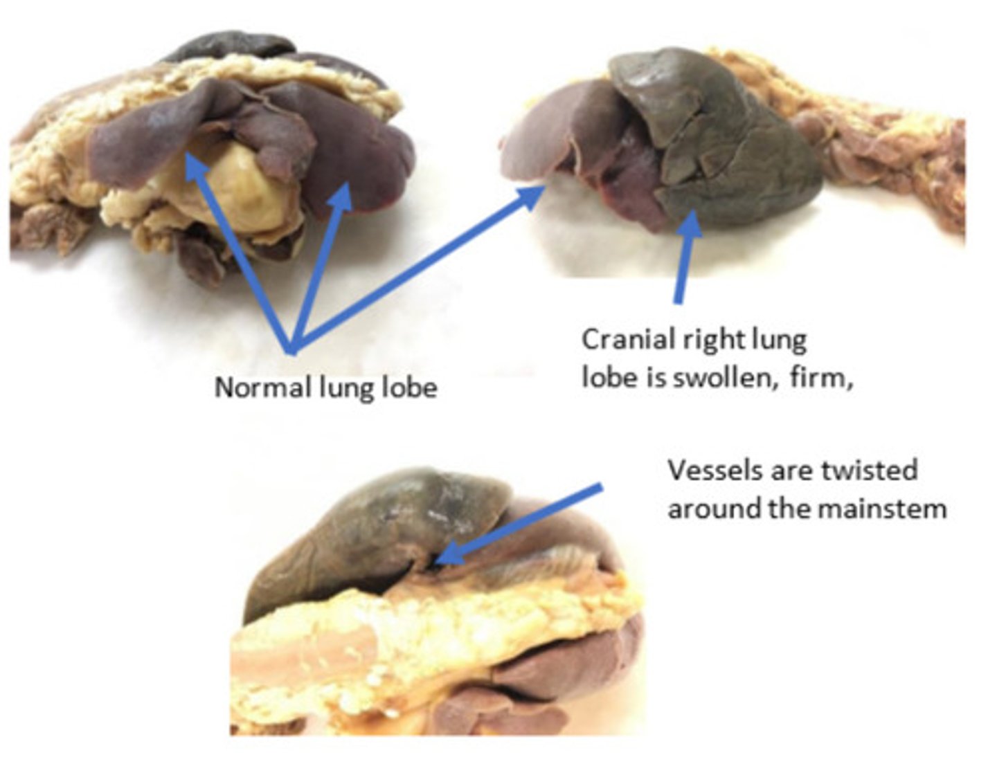 <p>Waht is lesion?</p>