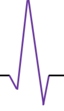 <p>ventricular depolarization </p>