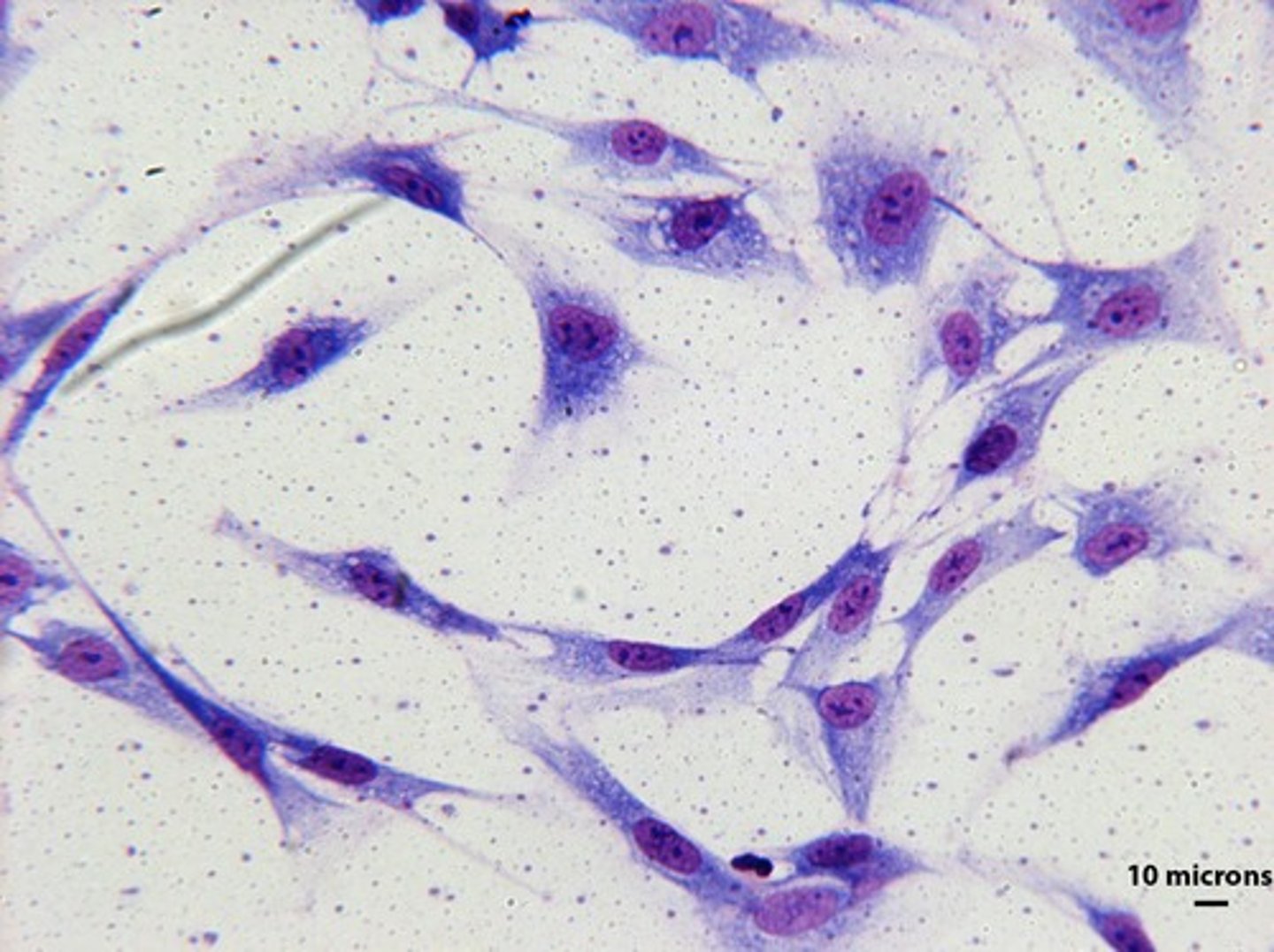 <p>bone-building cells</p>