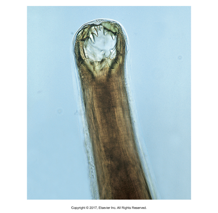 <p>Hookworm</p><ul><li><p>Ancylostoma: worldwide, Uncinaria: N. America​</p></li><li><p>Ancylostoma: curved mouth; Uncinaria: hooked nose​</p></li><li><p>A. caninum: dog, A. tubaeform: cat, A. braziliense: cat and dog​, Uncinaria: dog only​</p></li><li><p>Cause of infection: Ingestion of eggs or through skin​</p></li><li><p>Attach to mucosa of small intestine, feed on blood, secrete anticoagulants​</p></li><li><p>Ancylostoma: three pairs of ventral teeth​</p></li><li><p>Symptoms: anemia, dark tarry stool, especially kittens and puppies​</p></li><li><p>Can spread through placenta and milk​</p></li><li><p>Oviparous: morulated egg released in feces, develop into L1 in environment​</p></li><li><p>L1 hatch, grow and molt into L2, grow and molt into infective L3​</p></li><li><p>Migrate to lungs, coughed up, swallowed ​</p></li><li><p>Matures in small intestine​</p></li><li><p>Prevention: Interceptor and Heartgard Plus ​</p></li><li><p>Treatment: mebendazole or fenbendazole</p></li></ul><p></p>