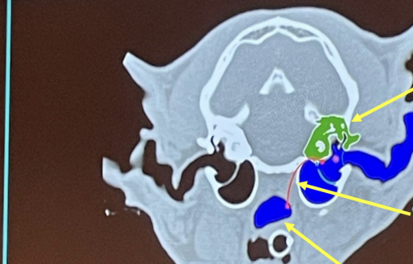 <p>What is the bottom arrow pointing to?</p>