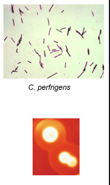 <ul><li><p>large rectangular GPB</p></li><li><p>subterminal spores, seldom seen</p></li><li><p>non motile</p></li><li><p>produces several toxins</p><ul><li><p>alpha (lecithinase)</p></li><li><p>beta (necrotizing enteritis)</p></li><li><p>Enterotoxin</p></li></ul></li><li><p><u>double zone of hemolysis</u></p></li></ul><p></p>