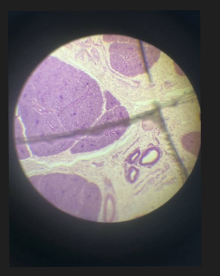 <p>Привушна залоза</p>