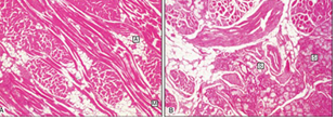 <ul><li><p>dorsal has both masticatory mucosa of orthokeratinized stratified squamous epithelium and specialized mucosa</p></li></ul><p></p>