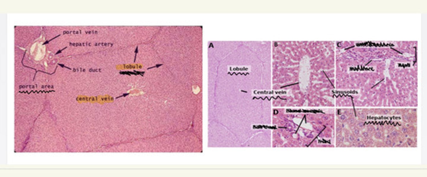 <p>i. Liver lobule</p><p>ii. Portal area</p><p>iii. Central vein i</p><p>v. Hepatocyte</p><p>v. Liver sinusoids</p>