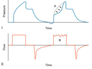 <p>What does this indicate?</p>